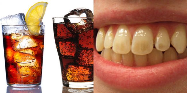 sức khỏe răng miệng